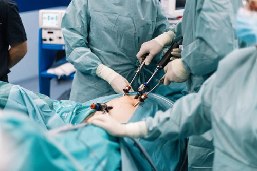 Top Advanced Laparoscopic Surgery Doctor in Dombivli